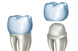 crowns to restore tooth